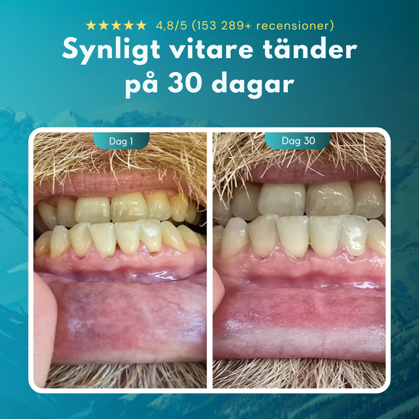 Mintara™ | Sluta Borsta, Börja Tugga