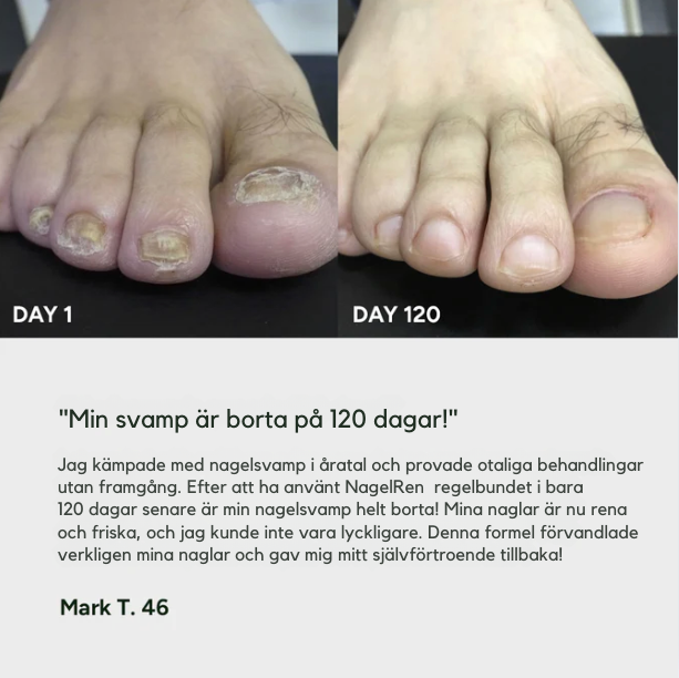 NagelRen | Gel för behandling av nagelsvamp