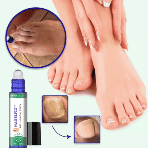 NagelFix™ Roll-on | Ingen mer nagelsvamp på 5 dagar!